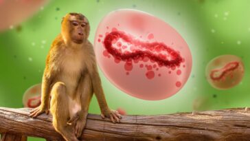 Monkeypox