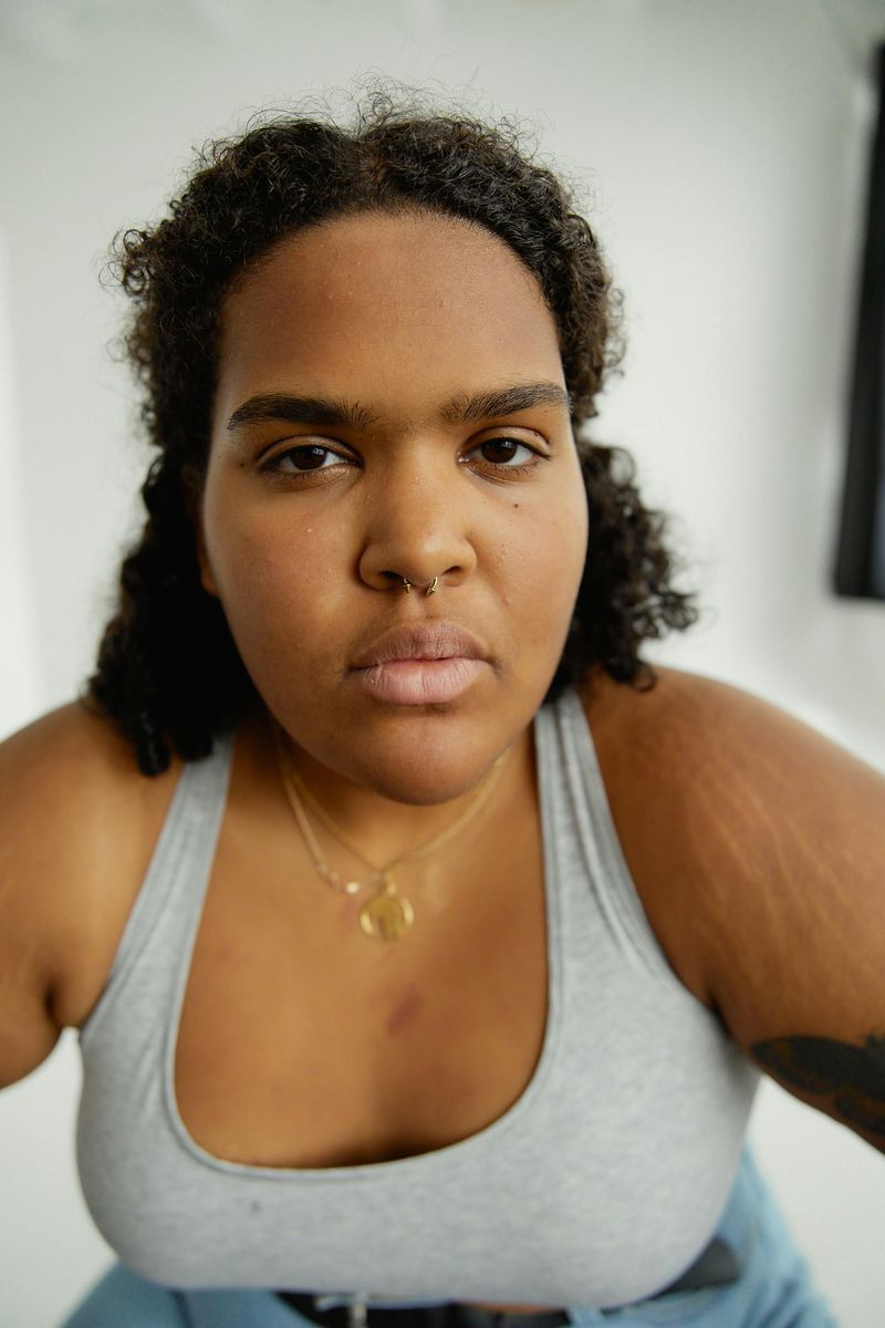 Stretch Marks