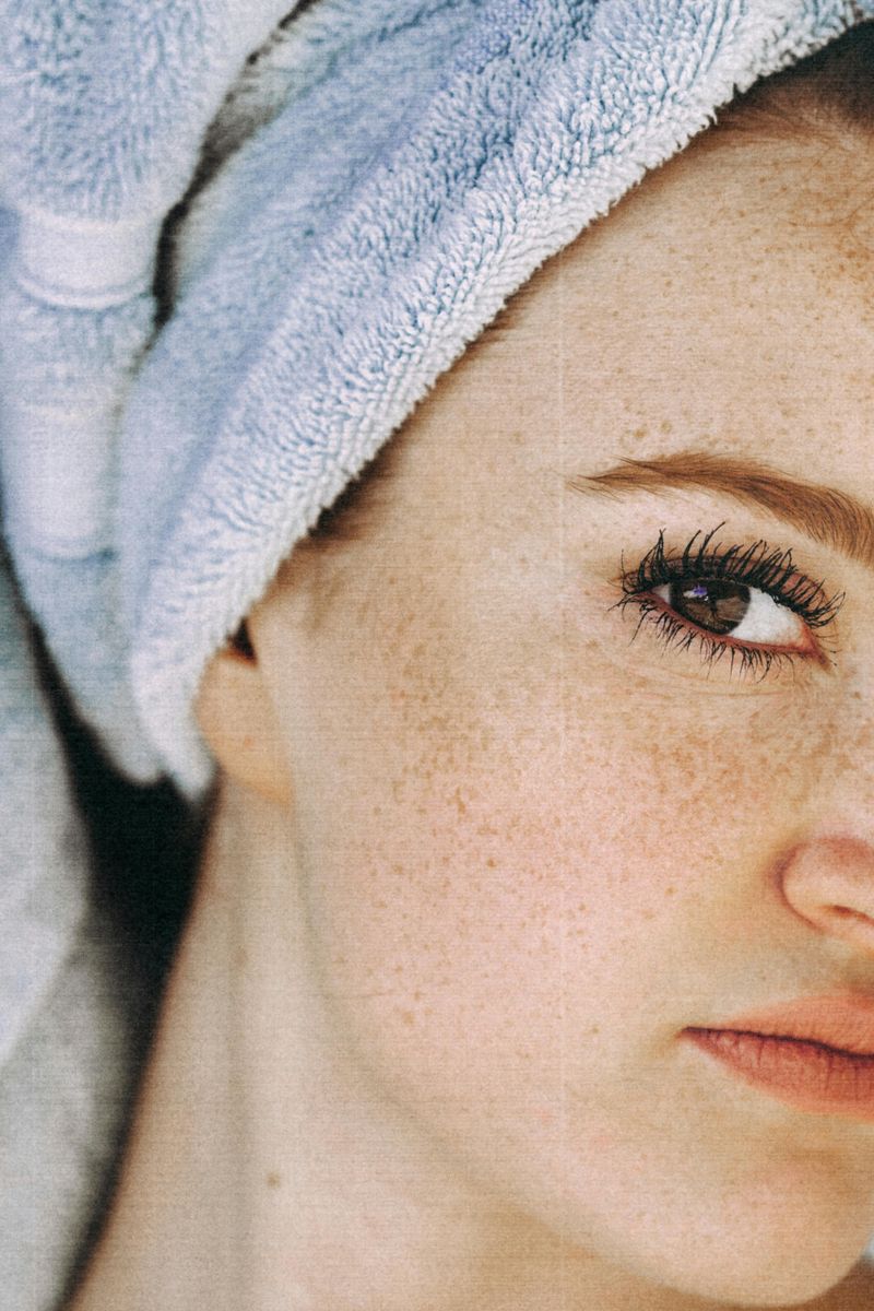 Freckles