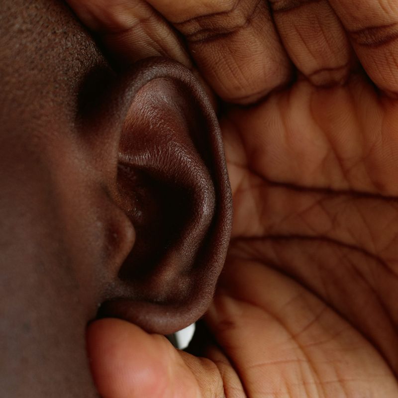 Preauricular Pit: A Tiny Ear Hole