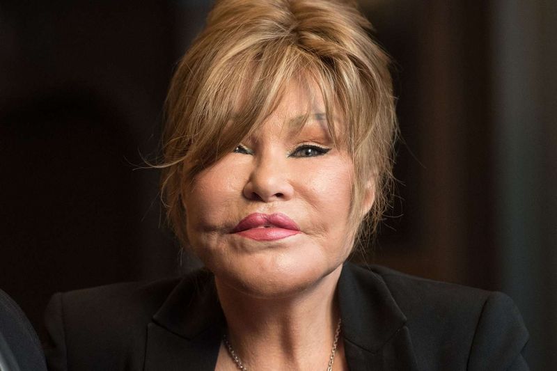 Jocelyn Wildenstein: The Cautionary Tale